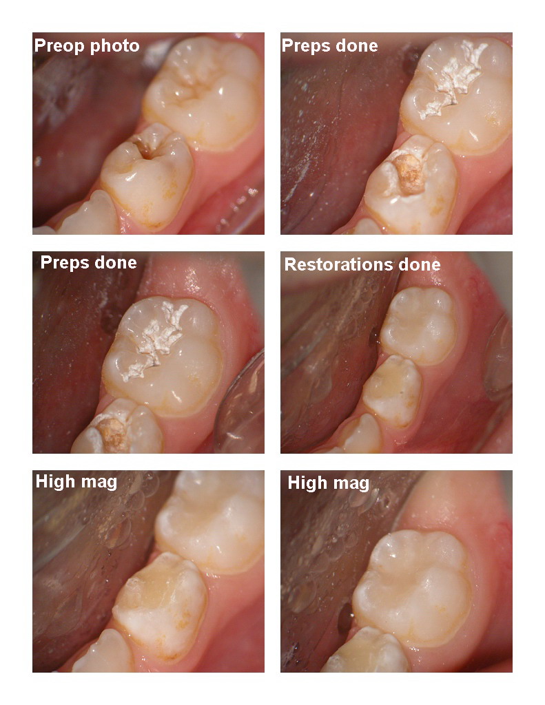 Large occlusals pg 1.jpg